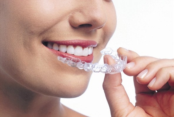 Få rettet tænder med en usynlig skinne – INVISALIGN