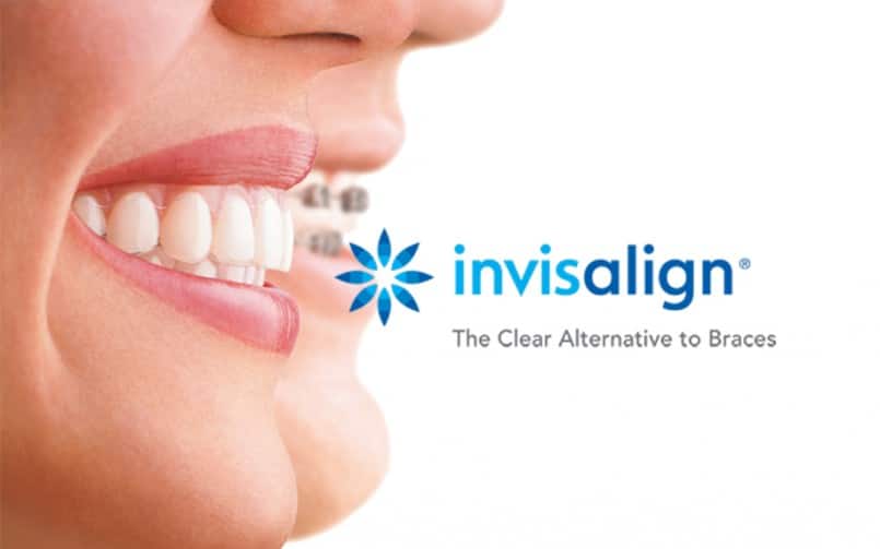 invisalign